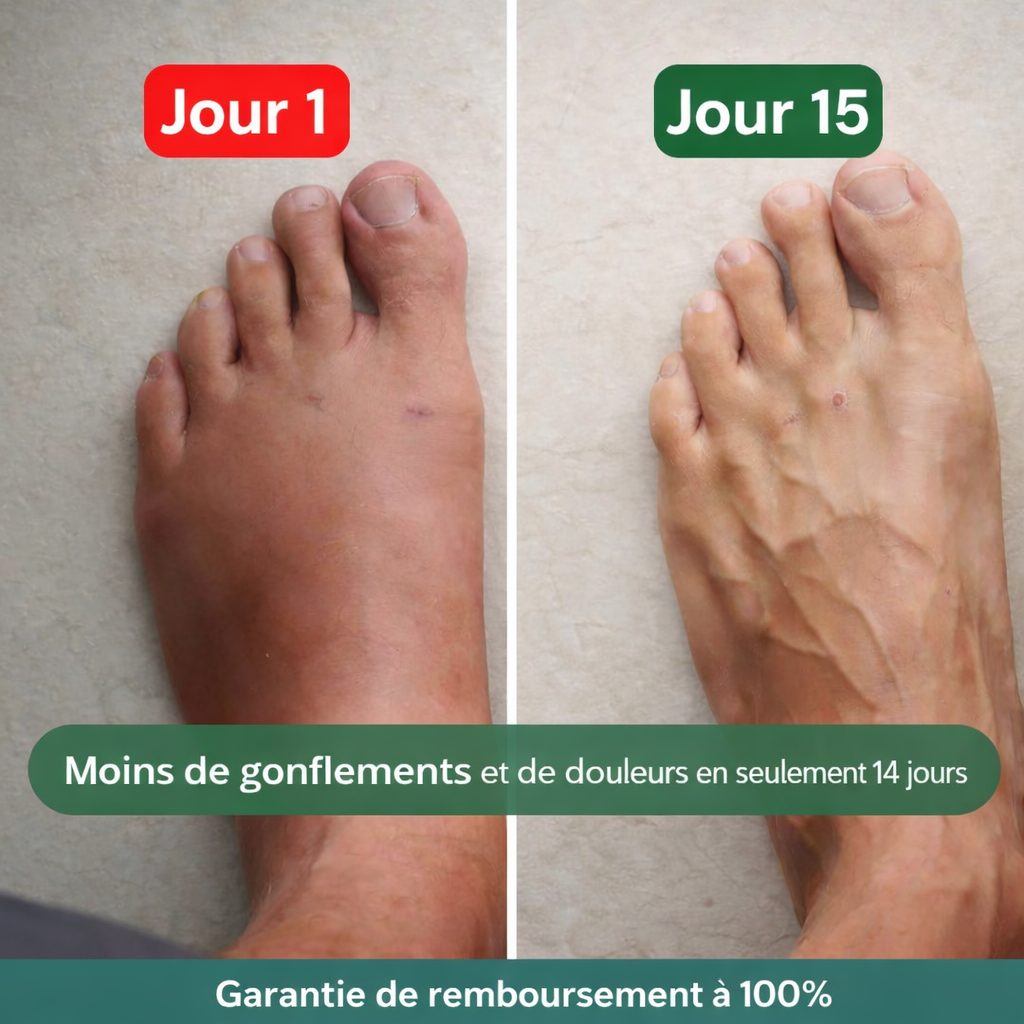 Altéos Paris® Chaussettes de compression pour jambes lourdes et douloureuses