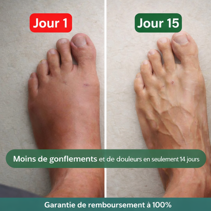 Altéos Paris® Chaussettes de compression pour jambes lourdes et douloureuses