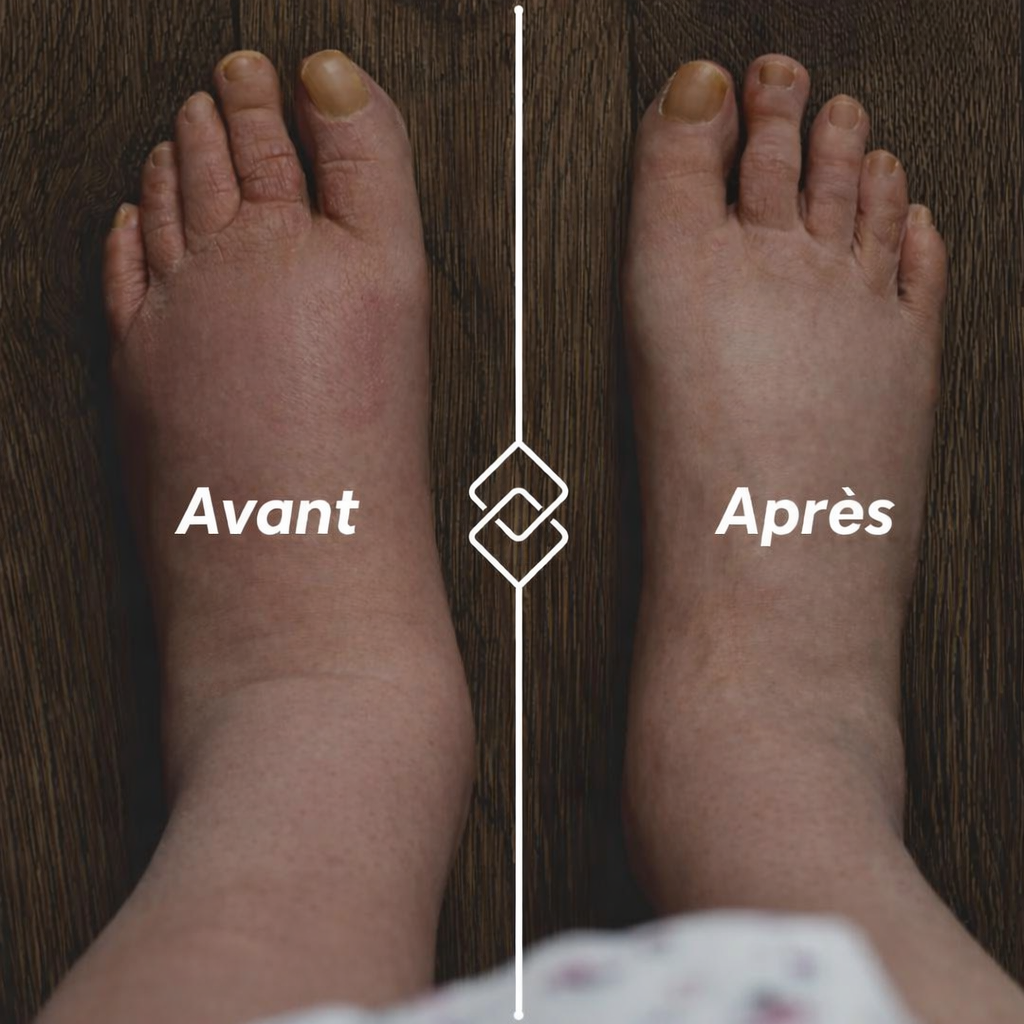 Altéos Paris® Chaussettes de compression pour jambes lourdes et douloureuses